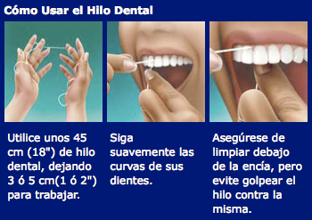 como usar el hilo dental correctamente