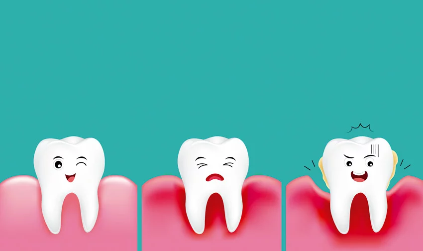 5 Señales de alerta de la Gingivitis Periodontitis